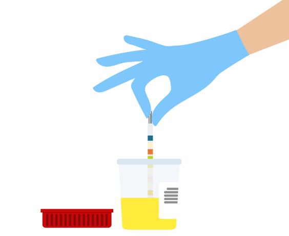 Graphique animé montrant le test d'urine pour analyse.